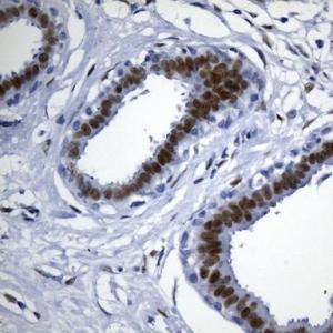 傲銳東源(OriGene)小鼠TLE1抗體(UM800143CF/UM870143/UM800143)